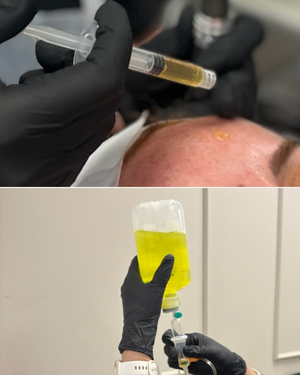 Intravenous Therapy (IV) & Platelet Rich Plasma (PRP) Inc Phlebotomy Course - No Kit