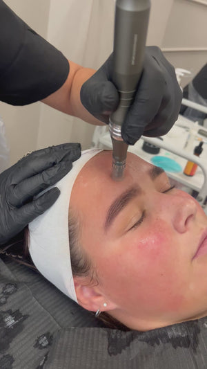 Micro-needling Course